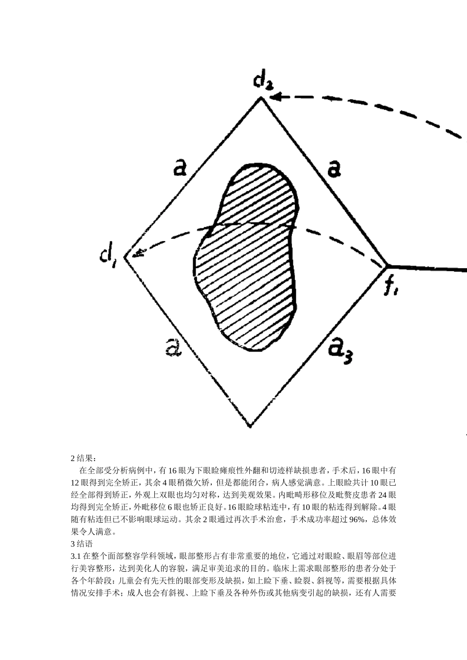 采用菱形(皮)瓣的眼科整形手术_第2页