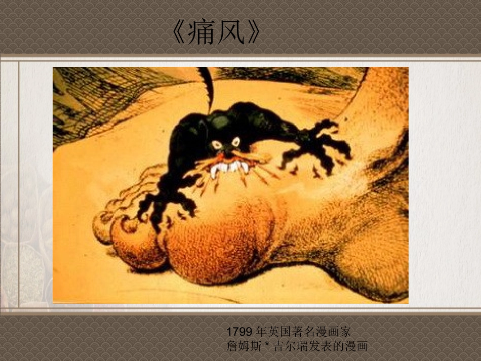 中医药治疗痛风PPT培训课件_第2页