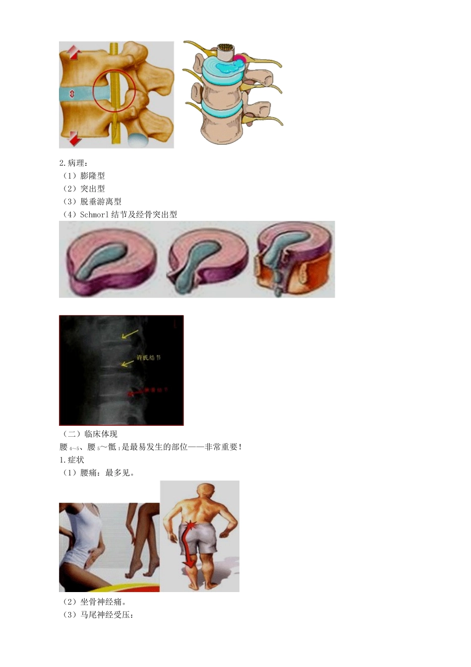 2024年主管护师外科讲义第四十七章腰腿痛及颈肩痛病人的护理_第2页