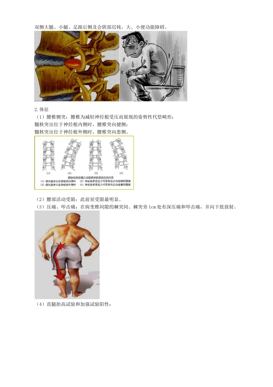 2024年主管护师外科讲义第四十七章腰腿痛及颈肩痛病人的护理_第3页