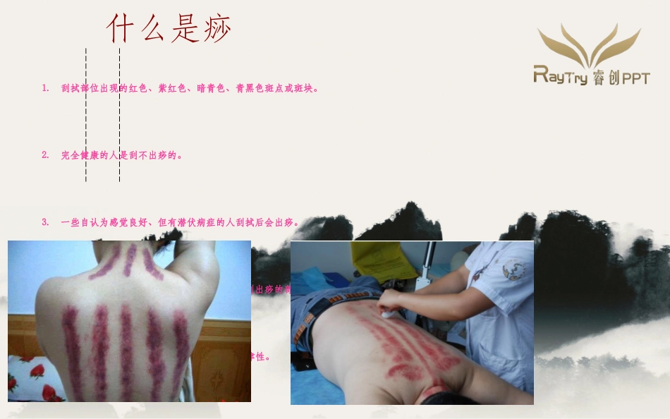 中医刮痧疗法PPT培训课件_第3页