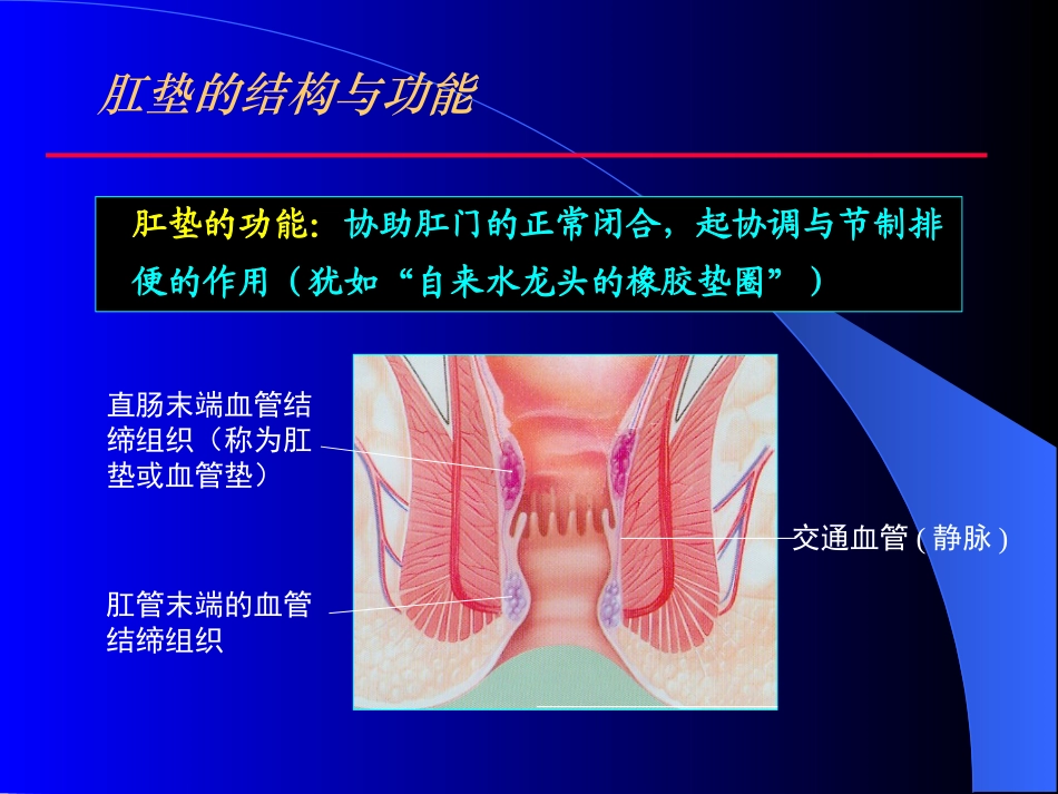 痔疮和套扎治疗PPT培训课件_第3页