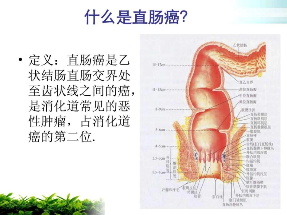 直肠癌护理查房PPT培训课件_第3页