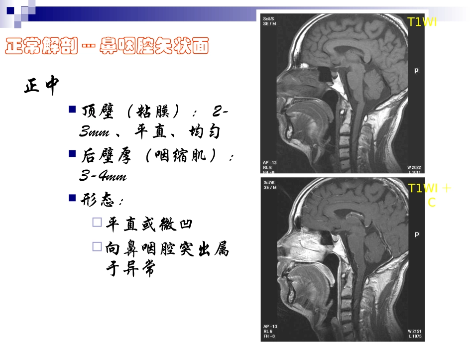 正常颈部解剖PPT培训课件_第1页