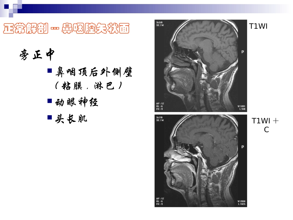 正常颈部解剖PPT培训课件_第2页