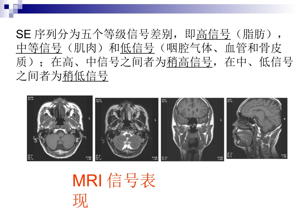 正常颈部解剖PPT培训课件_第3页