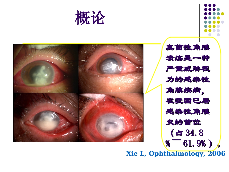 真菌性角膜炎PPT培训课件_第2页