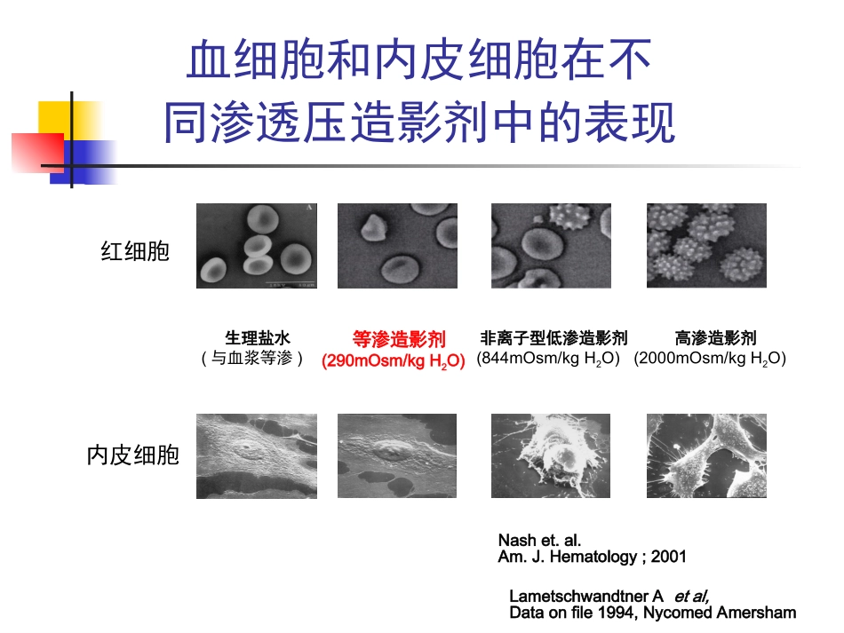造影剂肾病新PPT培训课件_第3页