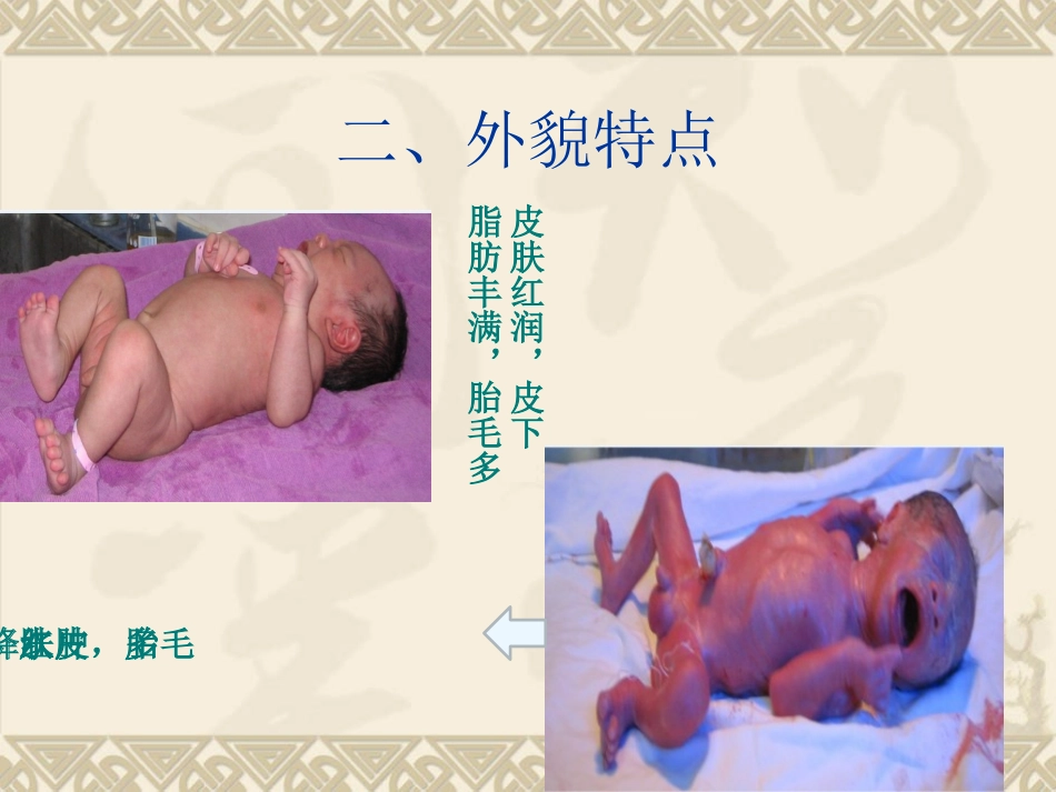 早产儿的护理PPT培训课件_第3页