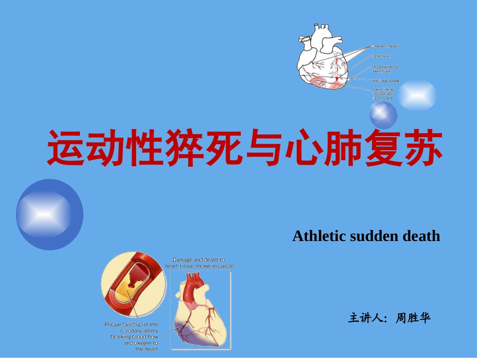 运动性猝死分析PPT培训课件_第1页