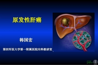 原发性肝癌PPT培训课件
