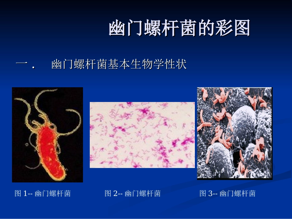 幽门螺旋杆菌pptPPT培训课件_第3页