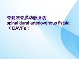 硬脊膜动静脉瘘PPT培训课件