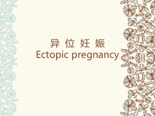 异位妊娠完整版PPT培训课件