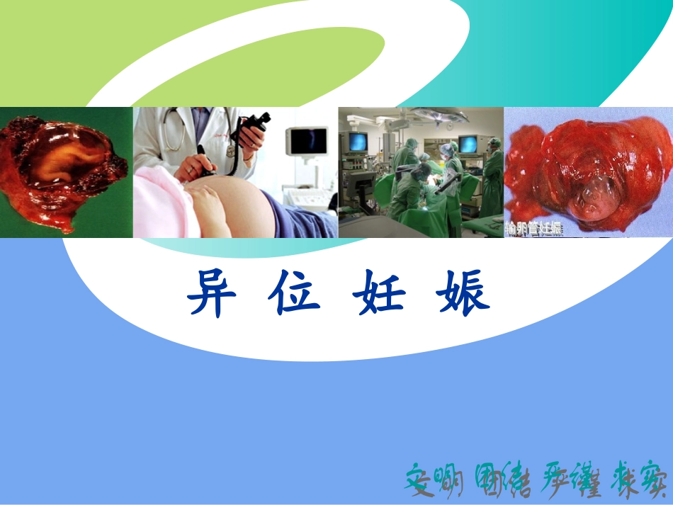 异位妊娠讲义PPT培训课件_第1页