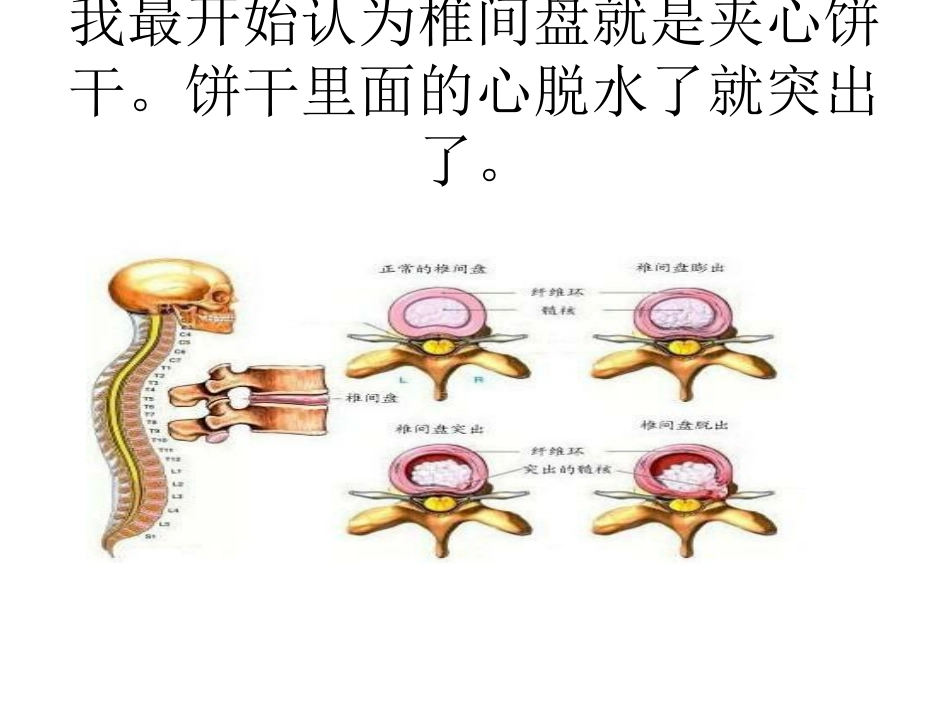 腰椎间盘查体PPT培训课件_第2页