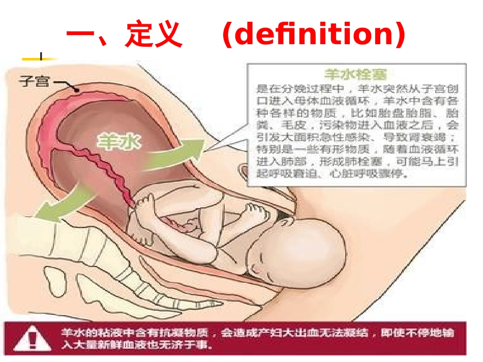 羊水栓塞的护理PPT培训课件_第3页
