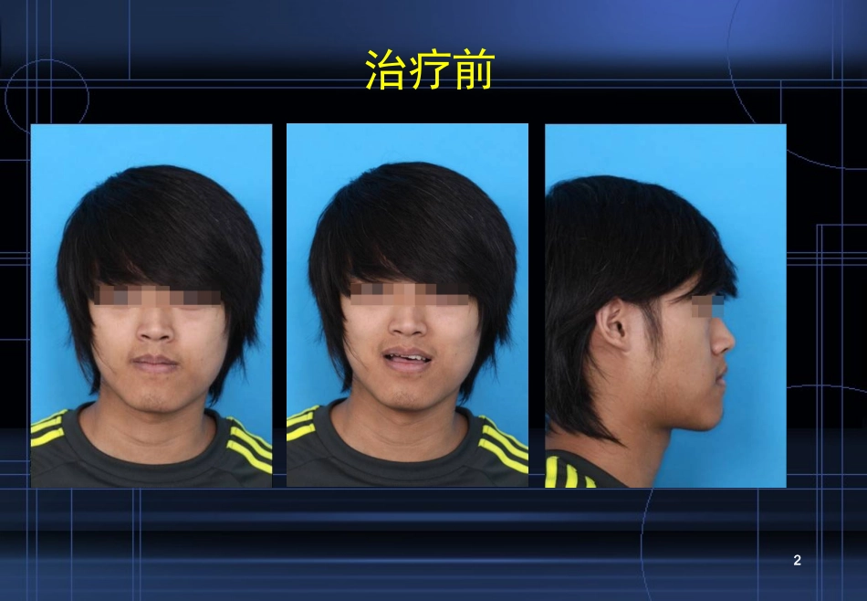牙齿矫正保持PPT培训课件_第2页