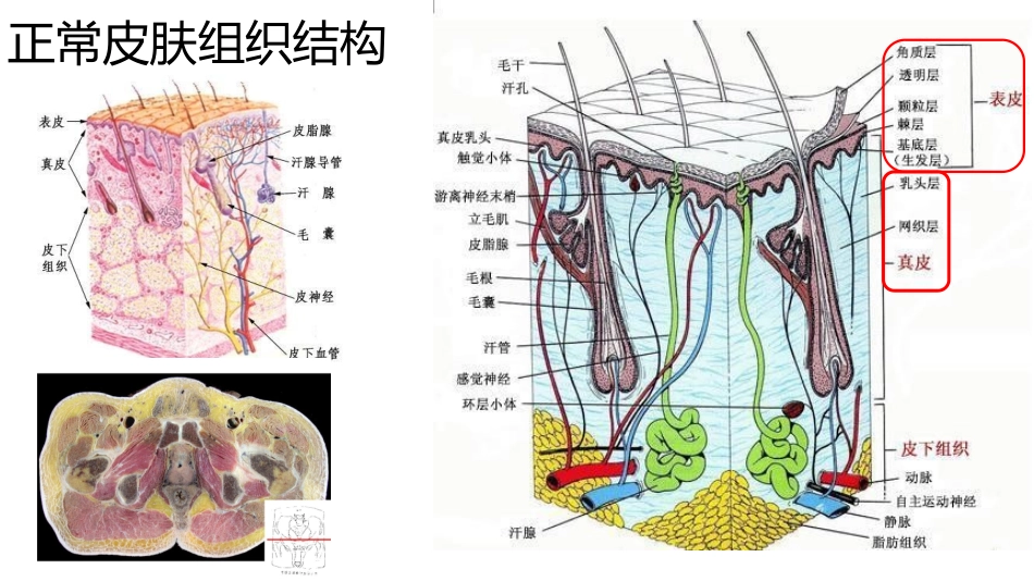 压力性损伤最新PPT培训课件_第2页