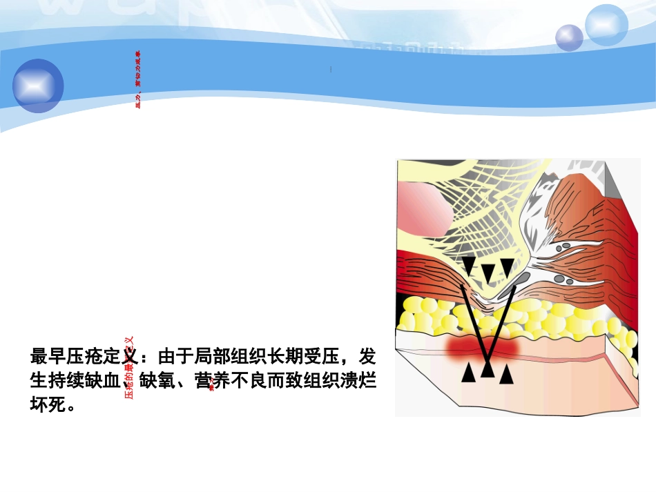 压疮的预防措施PPT培训课件_第2页