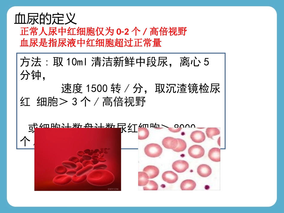 血尿诊断思路PPT培训课件_第3页