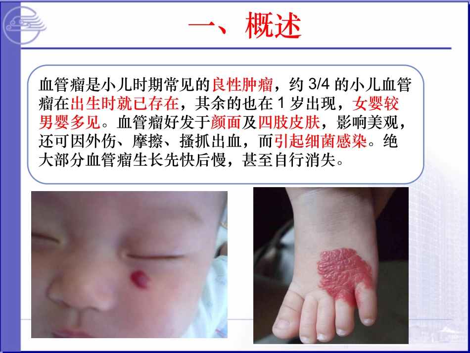 血管瘤的护理PPT培训课件_第3页