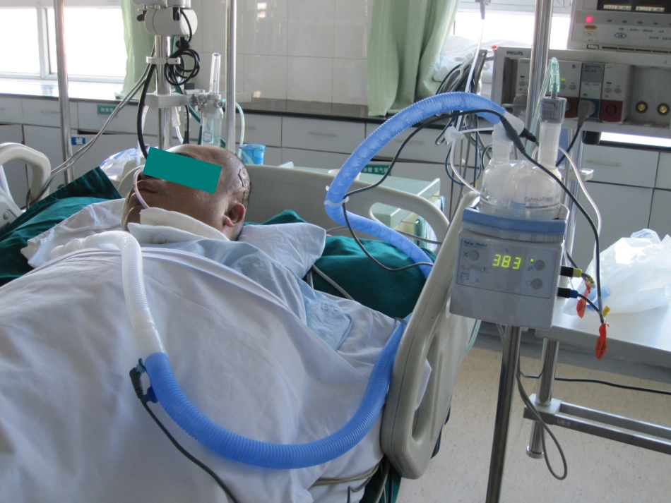 胸部物理治疗PPT培训课件_第2页