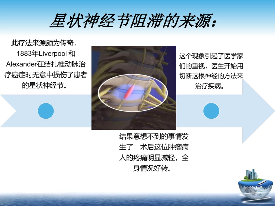 星状神经节阻滞PPT培训课件_第2页