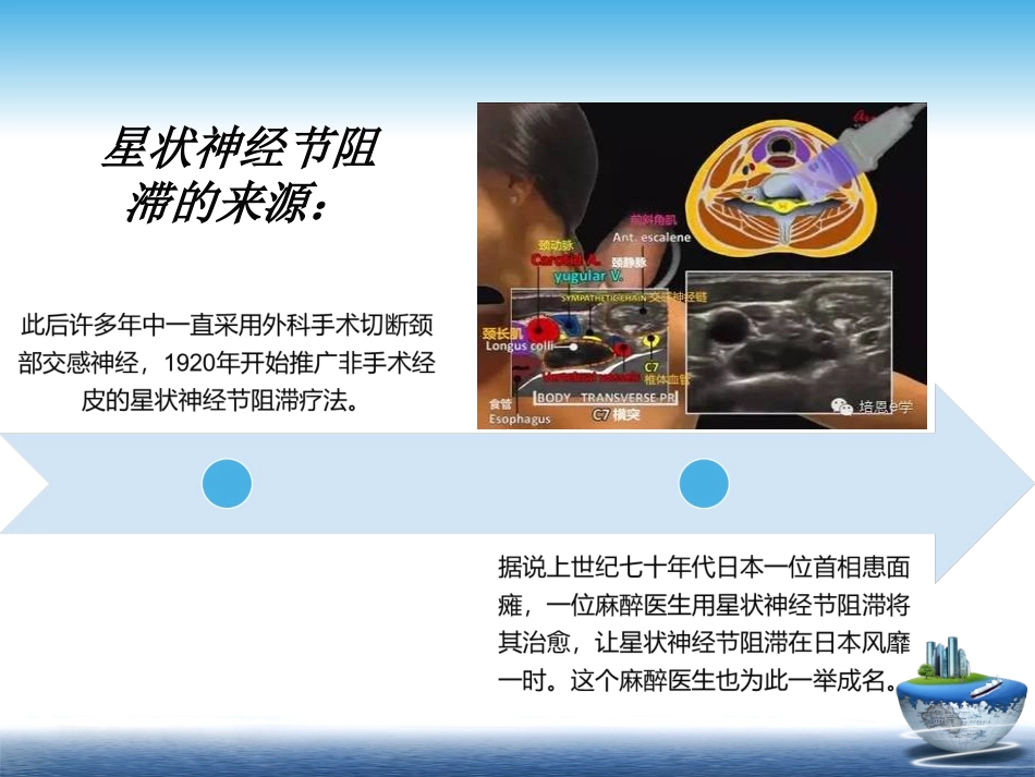 星状神经节阻滞PPT培训课件_第3页