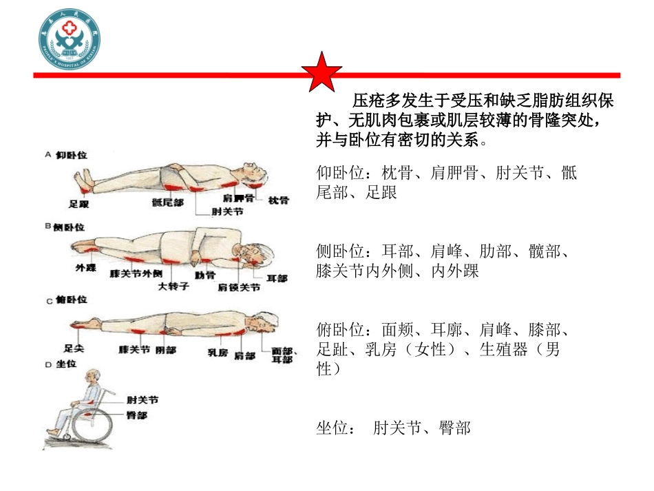 新护理压疮诊疗PPT培训课件_第3页