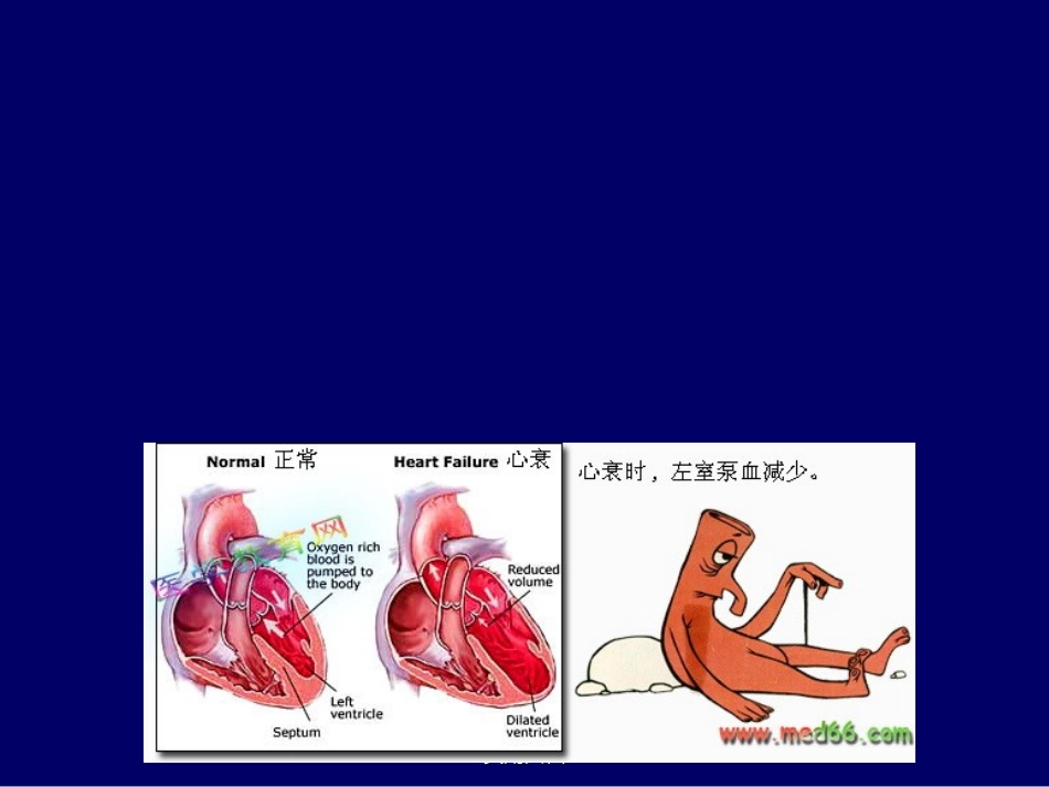 心力衰竭护理PPT培训课件_第3页