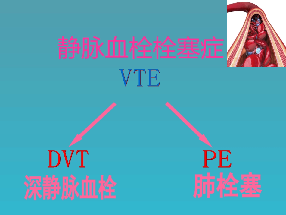 下肢深静脉血栓PPT培训课件_第2页