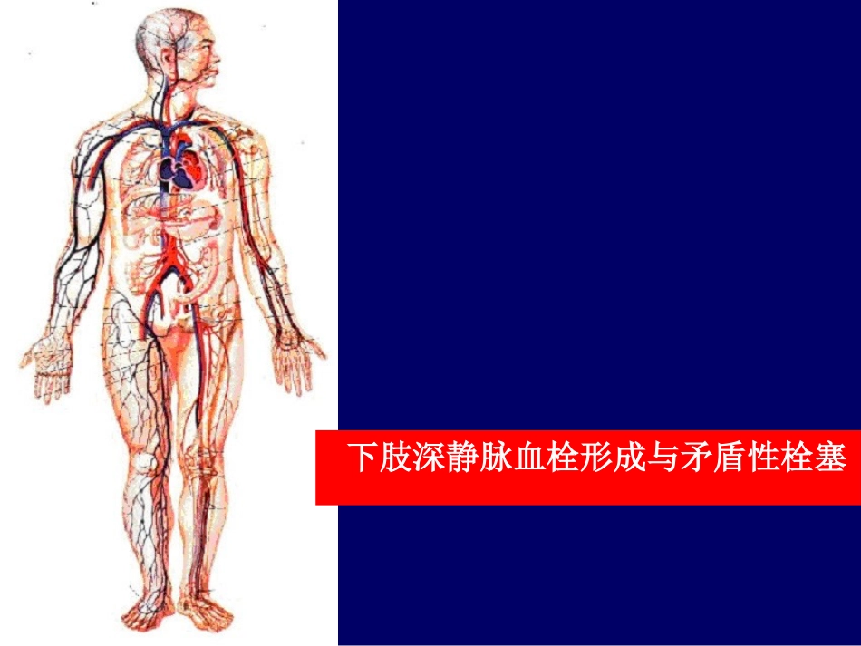 下肢静脉血栓PPT培训课件_第2页