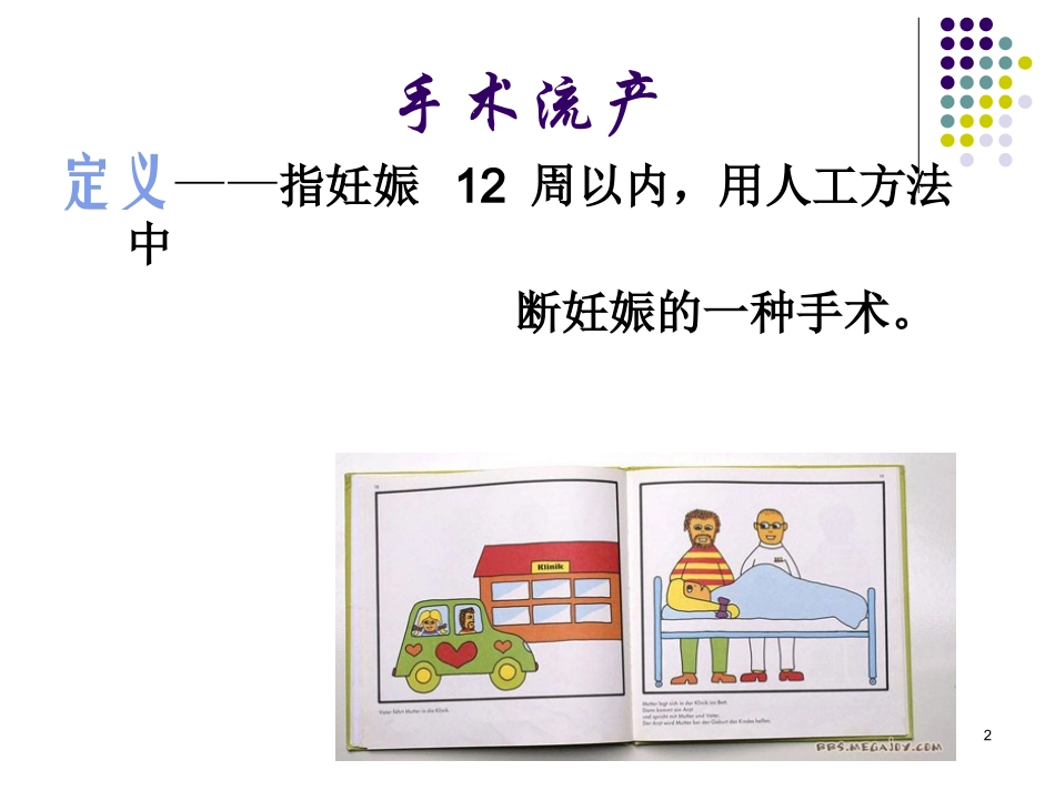 无痛人工流产术PPT培训课件_第2页