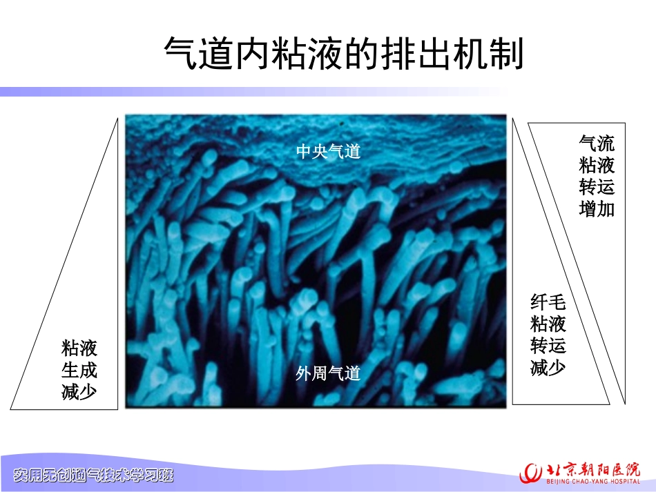 无创辅助排痰PPT培训课件_第3页