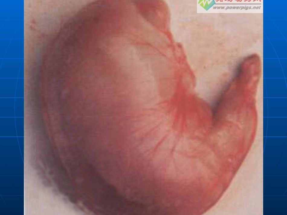 胃炎健康讲座PPT培训课件_第2页