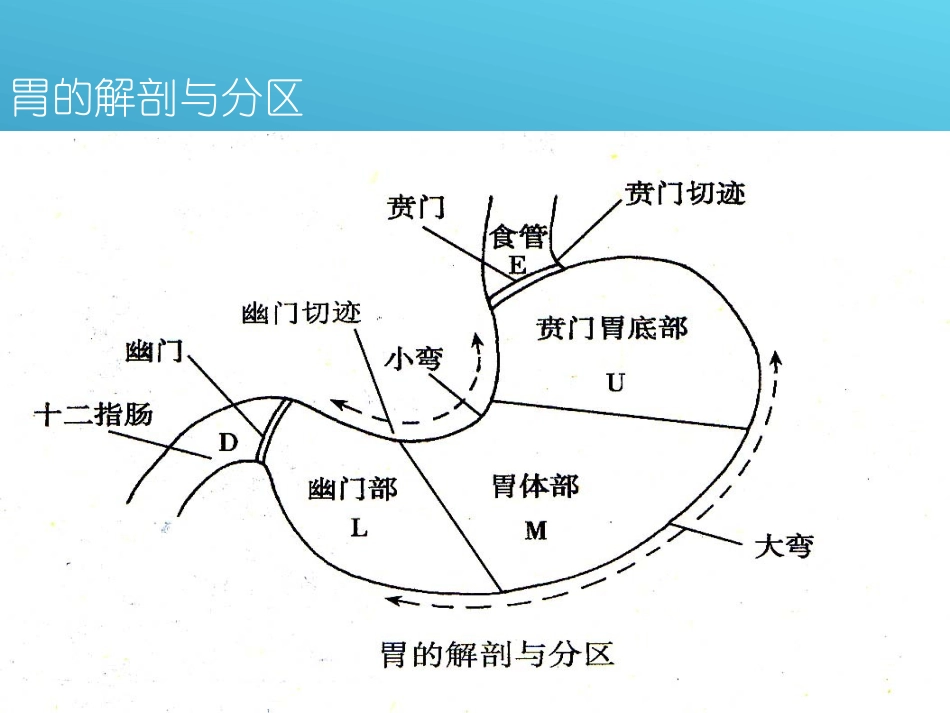 胃大部切除术PPT培训课件_第3页