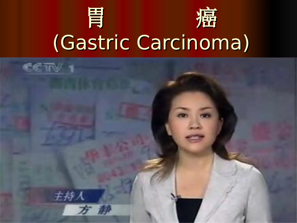 胃癌的临床治疗PPT培训课件_第1页