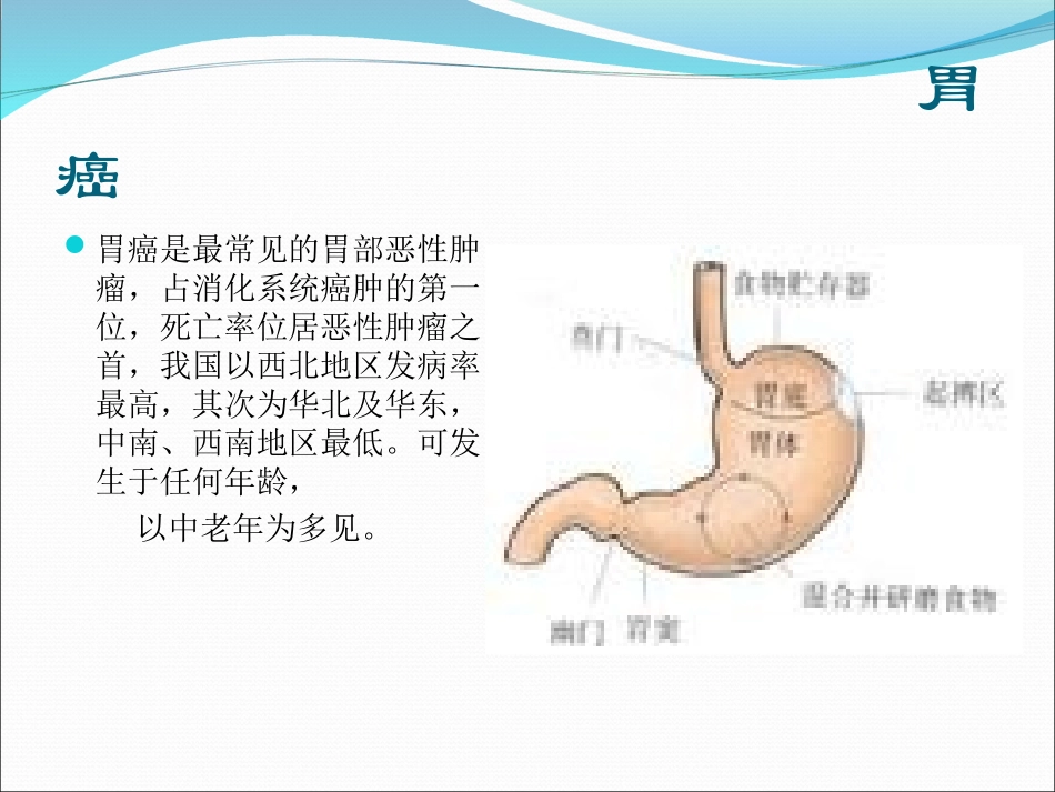 胃癌的护理查房PPT培训课件_第3页