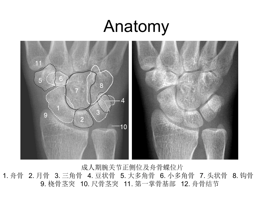 腕关节X线解剖PPT培训课件_第2页