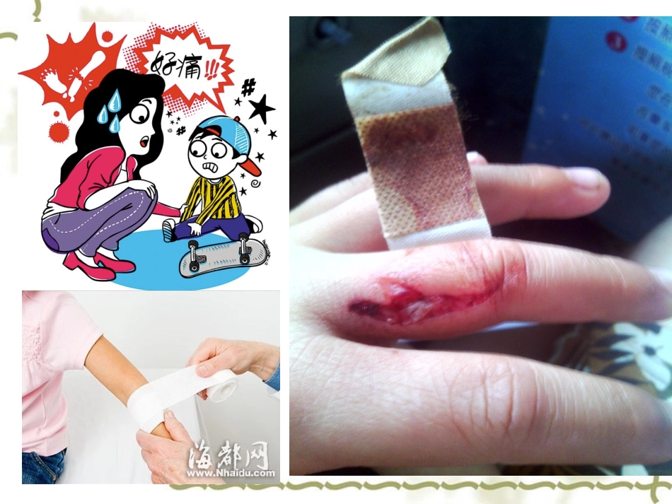 外伤止血包扎PPT培训课件_第3页