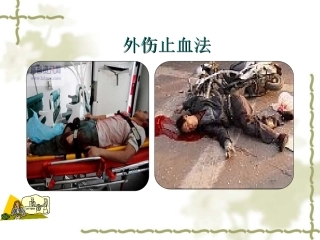 外伤止血包扎PPT培训课件