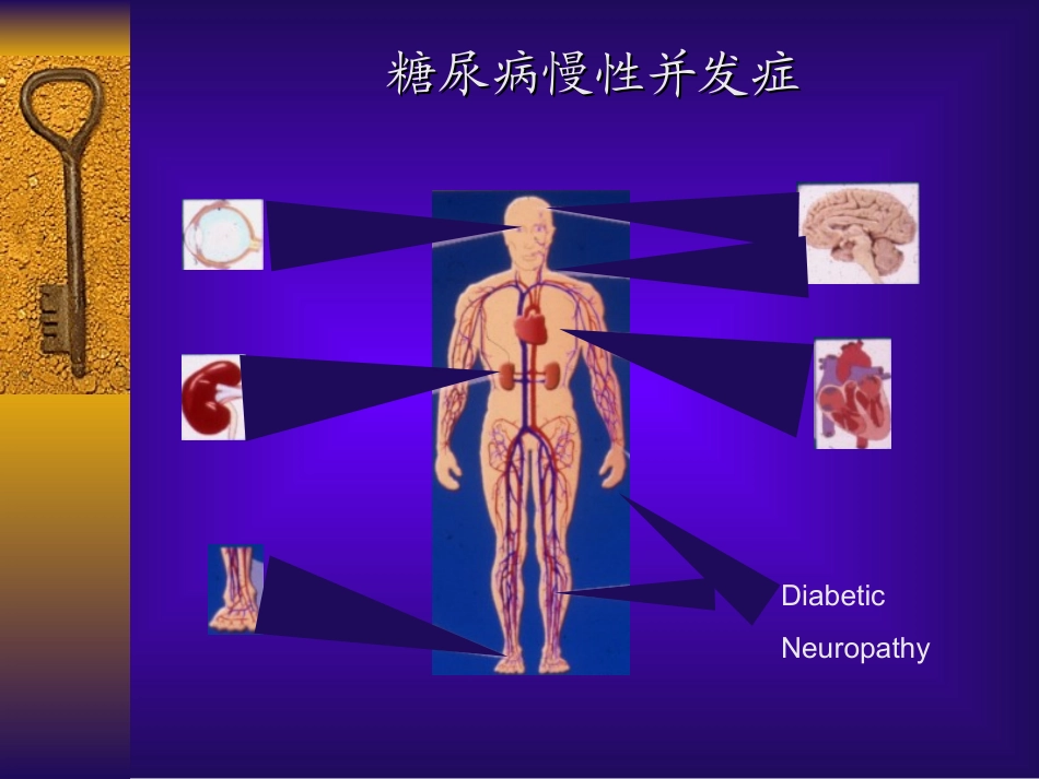 糖尿病并发症PPT培训课件_第3页