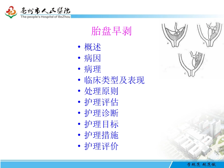 胎盘早剥护理PPT培训课件_第2页