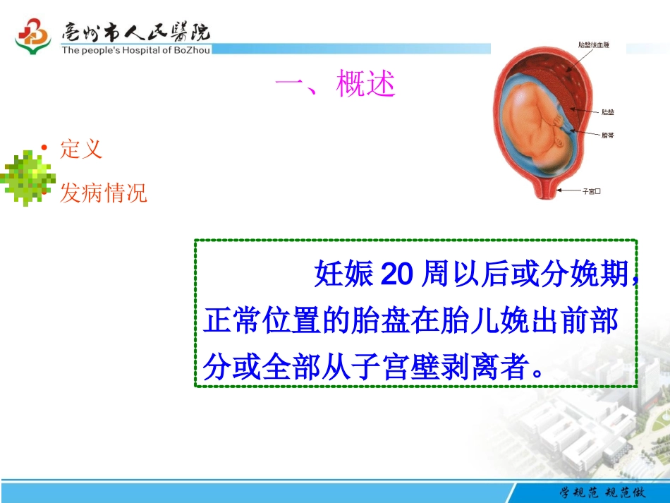 胎盘早剥护理PPT培训课件_第3页