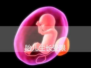 胎儿生长受限PPT培训课件