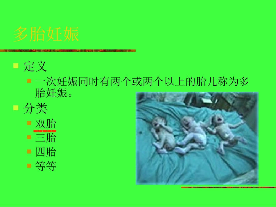 双胎妊娠的护理PPT培训课件_第2页