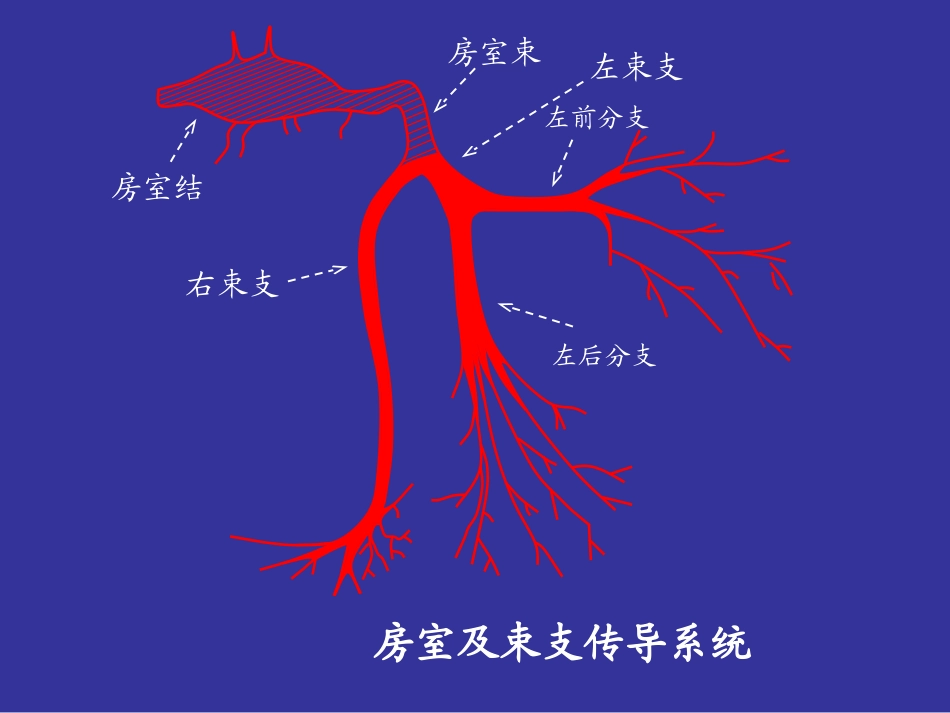 束支传导阻滞PPT培训课件_第3页