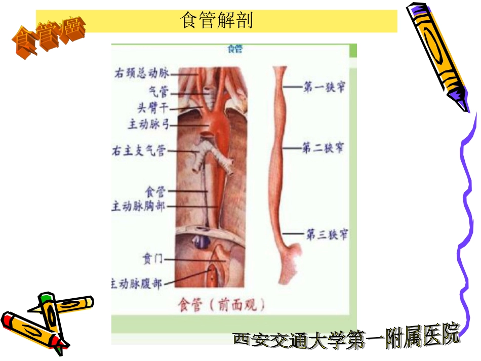 食管癌护理查房PPT培训课件_第3页