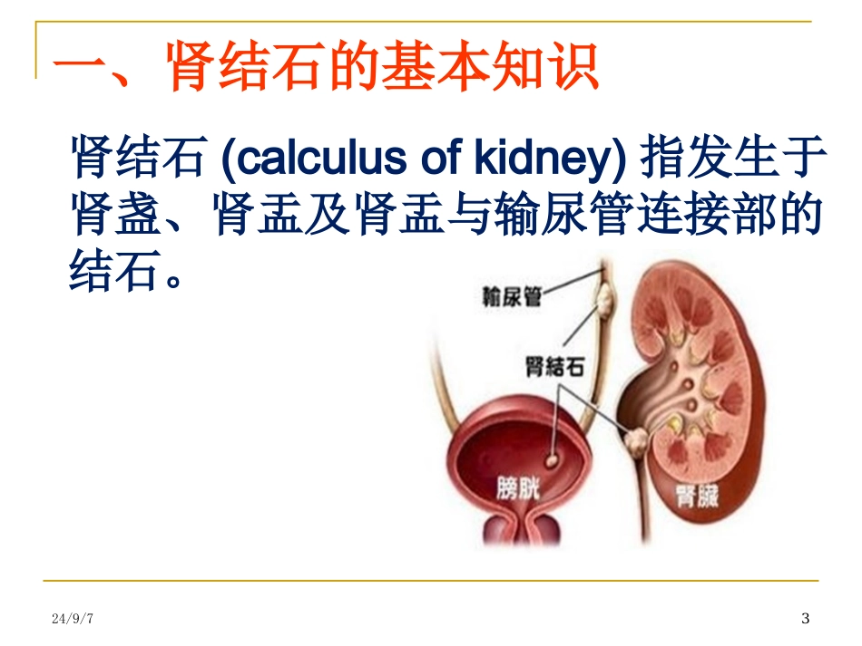 肾结石康复指导PPT培训课件_第3页